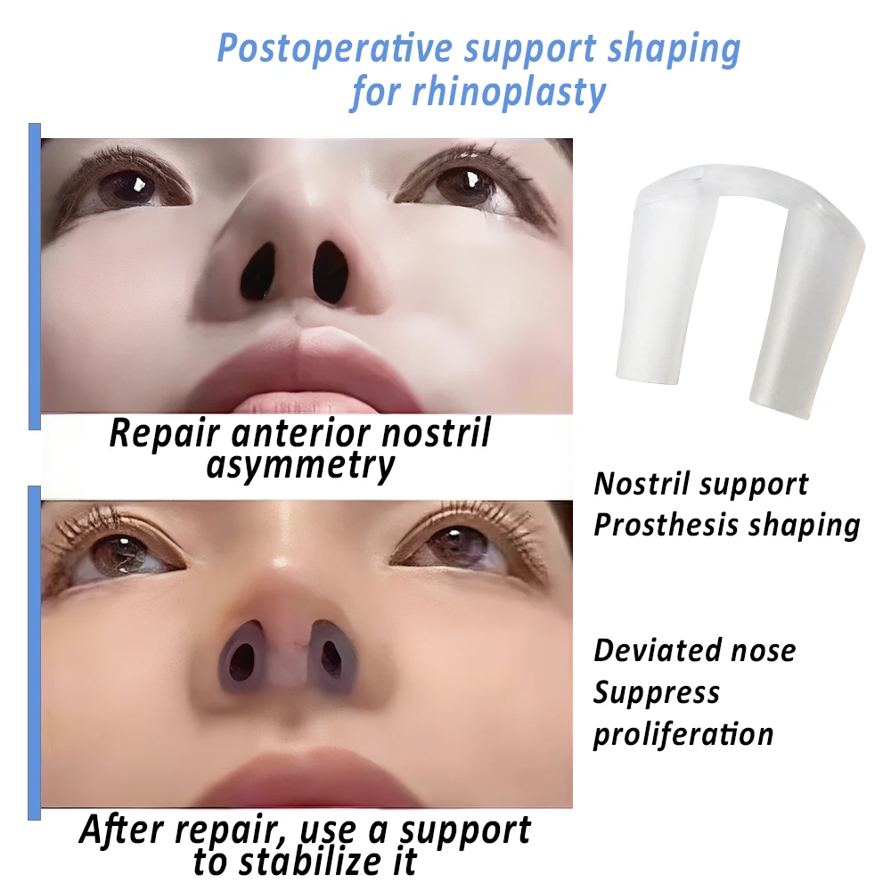 Silikonowy korektor do nosa po – Anti Snore Contour Pillow recenzja i cena
